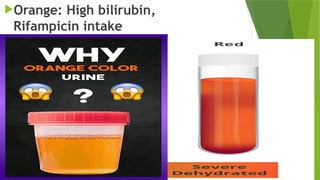 Orange: High bilirubin,
Rifampicin intake
 