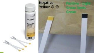 Negative
Yellow 🟡 🟡
Positive – Light
Grean Spots
Grean
 