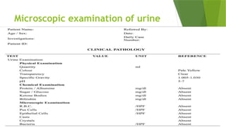 Microscopic examination of urine
 