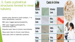 2. Casts (cylindrical
structures formed in renal
tubules)
Hyaline casts: Normal in small numbers, in
↑
fever, dehydration, exercise.
RBC casts: Suggest glomerulonephritis.
WBC casts: Suggest pyelonephritis,
interstitial nephritis.
Granular casts: Seen in chronic renal disease.
Waxy casts: Seen in chronic renal failure.
Fatty casts: Seen in nephrotic syndrome.
 