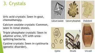 3. Crystals
Uric acid crystals: Seen in gout,
chemotherapy.
Calcium oxalate crystals: Common,
seen in renal stones.
Triple phosphate crystals: Seen in
alkaline urine, UTI with urea-
splitting bacteria.
Cystine crystals: Seen in cystinuria
(genetic disorder).
 