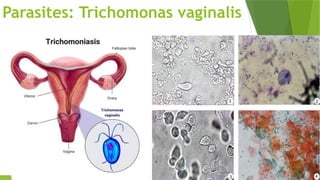 Parasites: Trichomonas vaginalis
 