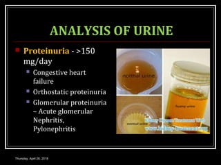 ANALYSIS OF URINE
 Proteinuria - >150
mg/day
 Congestive heart
failure
 Orthostatic proteinuria
 Glomerular proteinuria
– Acute glomerular
Nephritis,
Pylonephritis
Thursday, April 26, 2018
 