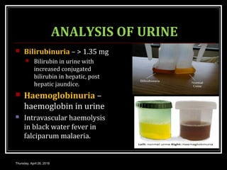 ANALYSIS OF URINE
 Bilirubinuria – > 1.35 mg
 Bilirubin in urine with
increased conjugated
bilirubin in hepatic, post
hepatic jaundice.
 Haemoglobinuria –
haemoglobin in urine
 Intravascular haemolysis
in black water fever in
falciparum malaeria.
Thursday, April 26, 2018
 