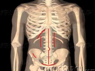 Renal incision | PPTX