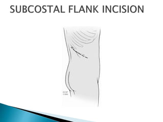 Renal incision | PPTX