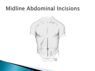Renal incision | PPTX
