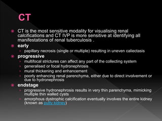 Renal infections radiology | PPTX