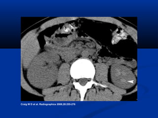 Craig W D et al. Radiographics 2008;28:255-276

 