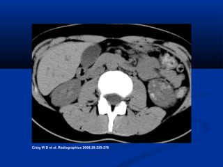 Craig W D et al. Radiographics 2008;28:255-276

 