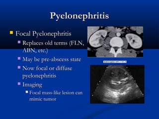 Pyelonephritis


Focal Pyelonephritis
Replaces old terms (FLN,
ABN, etc.)
 May be pre-abscess state
 Now focal or diffuse
pyelonephritis
 Imaging




Focal mass-like lesion can
mimic tumor

 