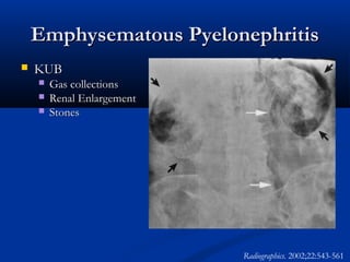 Emphysematous Pyelonephritis


KUB




Gas collections
Renal Enlargement
Stones

Radiographics. 2002;22:543-561

 