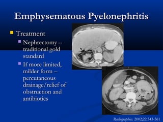 Emphysematous Pyelonephritis


Treatment
Nephrectomy –
traditional gold
standard
 If more limited,
milder form –
percutaneous
drainage/relief of
obstruction and
antibiotics


Radiographics. 2002;22:543-561

 