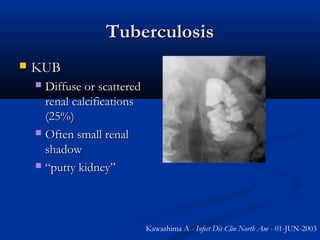 Tuberculosis


KUB
Diffuse or scattered
renal calcifications
(25%)
 Often small renal
shadow
 “putty kidney”


Kawashima A - Infect Dis Clin North Am - 01-JUN-2003

 