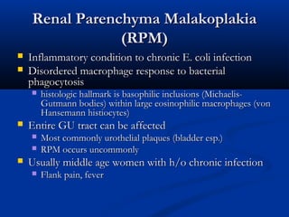 Renal Parenchyma Malakoplakia
(RPM)



Inflammatory condition to chronic E. coli infection
Disordered macrophage response to bacterial
phagocytosis




Entire GU tract can be affected





histologic hallmark is basophilic inclusions (MichaelisGutmann bodies) within large eosinophilic macrophages (von
Hansemann histiocytes)
Most commonly urothelial plaques (bladder esp.)
RPM occurs uncommonly

Usually middle age women with h/o chronic infection


Flank pain, fever

 