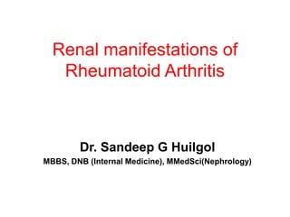 Renal manifestations of
Rheumatoid Arthritis
Dr. Sandeep G Huilgol
MBBS, DNB (Internal Medicine), MMedSci(Nephrology)
 