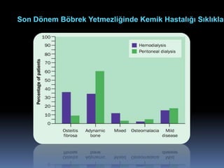 Son Dönem Böbrek Yetmezliğinde Kemik Hastalığı Sıklıklar
 