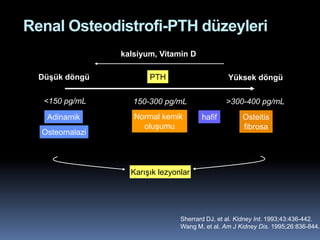 Renal Osteodistrofi-PTH düzeyleri
                kalsiyum, Vitamin D

  Düşük döngü          PTH                      Yüksek döngü

   <150 pg/mL      150-300 pg/mL               >300-400 pg/mL
   Adinamik        Normal kemik        hafif         Osteitis
                     oluşumu                         fibrosa
  Osteomalazi



                  Karışık lezyonlar




                                Sherrard DJ, et al. Kidney Int. 1993;43:436-442.
                                Wang M, et al. Am J Kidney Dis. 1995;26:836-844.
 
