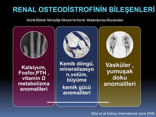 RENAL OSTEODİSTROFİNİN BİLEŞENLERİ
    Kronik Böbrek Yetmezliği- Mineral Ve Kemik Metabolizması Bozuklukları




                           Kemik döngü,                     Vasküler ,
  Kalsiyum,                mineralizasyo
 Fosfor,PTH ,                n,volüm,
                                                            yumuşak
  vitamin D                   büyüme                          doku
 metabolizma                                               anomalileri
 anomalileri                kemik gücü
                            anomalileri


                                                  Moe et al Kidney International June 2006
 