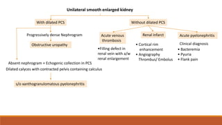 Without dilated PCS
Unilateral smooth enlarged kidney
Progressively dense Nephrogram
Obstructive uropathy
With dilated PCS
Absent nephrogram + Echogenic collection in PCS
Dilated calyces with contracted pelvis containing calculus
s/o xanthogranulomatous pyelonephritis
Acute venous
thrombosis
Renal infarct
• Cortical rim
enhancement
• Angiography
Thrombus/ Embolus
•Filling defect in
renal vein with a/w
renal enlargement
Acute pyelonephritis
Clinical diagnosis
• Bacteremia
• Pyuria
• Flank pain
 
