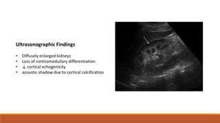 Ultrasonographic Findings
• Diffusely enlarged kidneys
• Loss of corticomedullary differentiation
• ↓ cortical echogenicity
• acoustic shadow due to cortical calcification
 