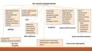 B/L smooth enlarged kidneys
Neonatal/Juvenile
age group
Associated with
striated
nephrogram
Periportal fibrosis
Dilated bile ducts
F/O PH
ARPCKD
Dilated PCS
Delayed contrast excretion
B/L obst
Uropathy
- Increase serum urea level
- Nephrogram- progressively
dense
Intense hyperechoic
cortex with
hypoechoic medulla
HUS
Elderly pt.
Osteopenia
vert. body &
Mandibular
involvement
Mult. Myeloma
Child with
abnormal
peripheral smear
increase WBC
count
Changes in bone
Leukemia
Absent cortical
nephrogram
with selective
enhancement
of medulla +
Tram line
calcification
Acute cortical necrosis
Renal
involvement
following
History of drug
exposure
Clinical features-
• Rash
• Eosinophila
• Proteinuria
• Hematuria
• Azotemia
Acute interstitial nephritis
Acute urate nephropathy
 
