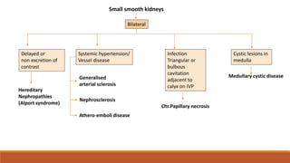 Small smooth kidneys
Bilateral
Delayed or
non excretion of
contrast
Hereditary
Nephropathies
(Alport syndrome)
Systemic hypertension/
Vessel disease
Generalised
arterial sclerosis
Nephrosclerosis
Athero-emboli disease
Infection
Triangular or
bulbous
cavitation
adjacent to
calyx on IVP
Chr.Papillary necrosis
Cystic lesions in
medulla
Medullary cystic disease
 