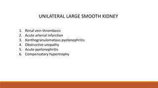UNILATERAL LARGE SMOOTH KIDNEY
1. Renal vein thrombosis
2. Acute arterial infarction
3. Xanthogranulomatous pyelonephritis
4. Obstructive uropathy
5. Acute pyelonephritis
6. Compensatory hypertrophy
 
