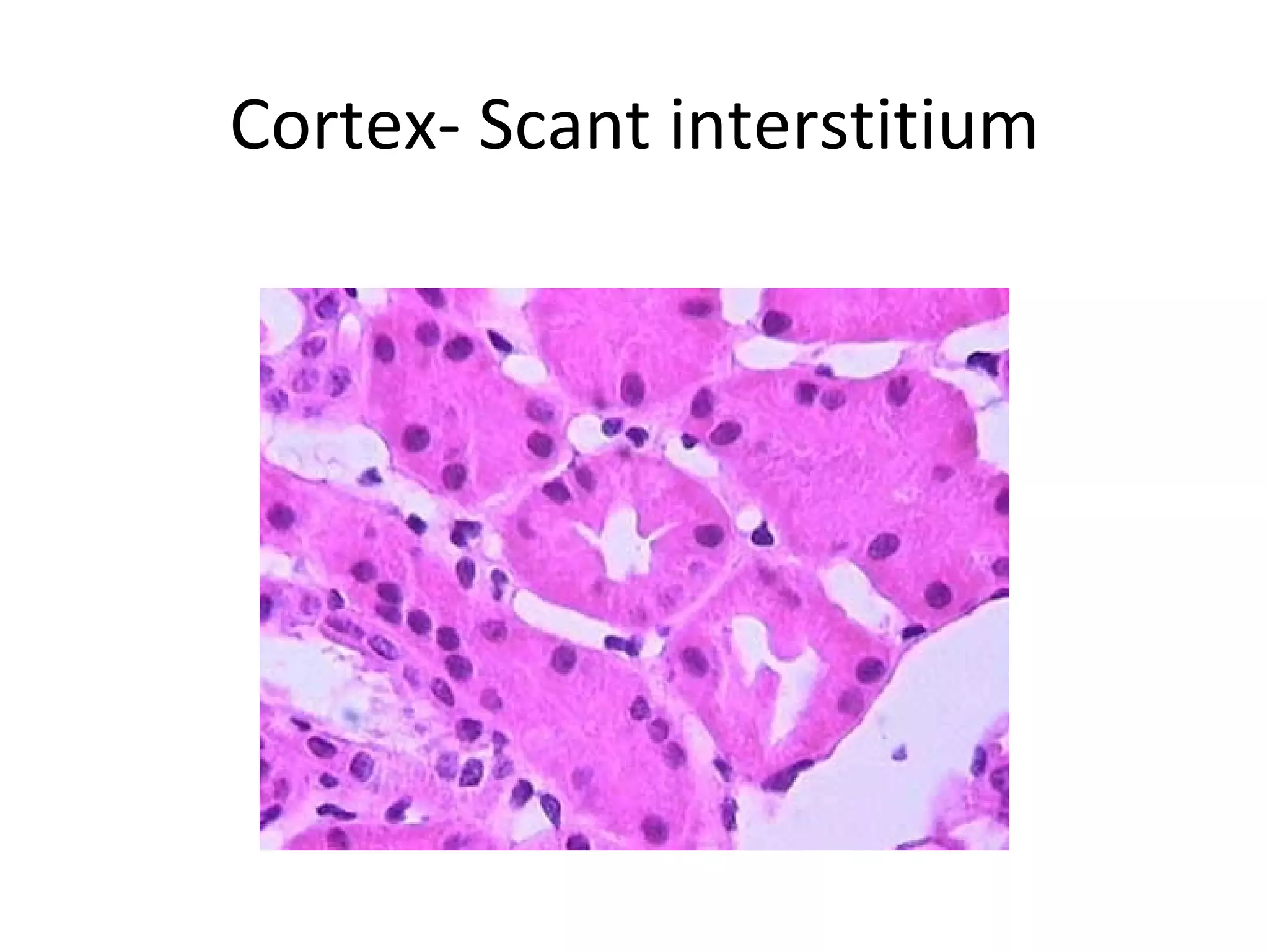 Cortex- Scant interstitium 