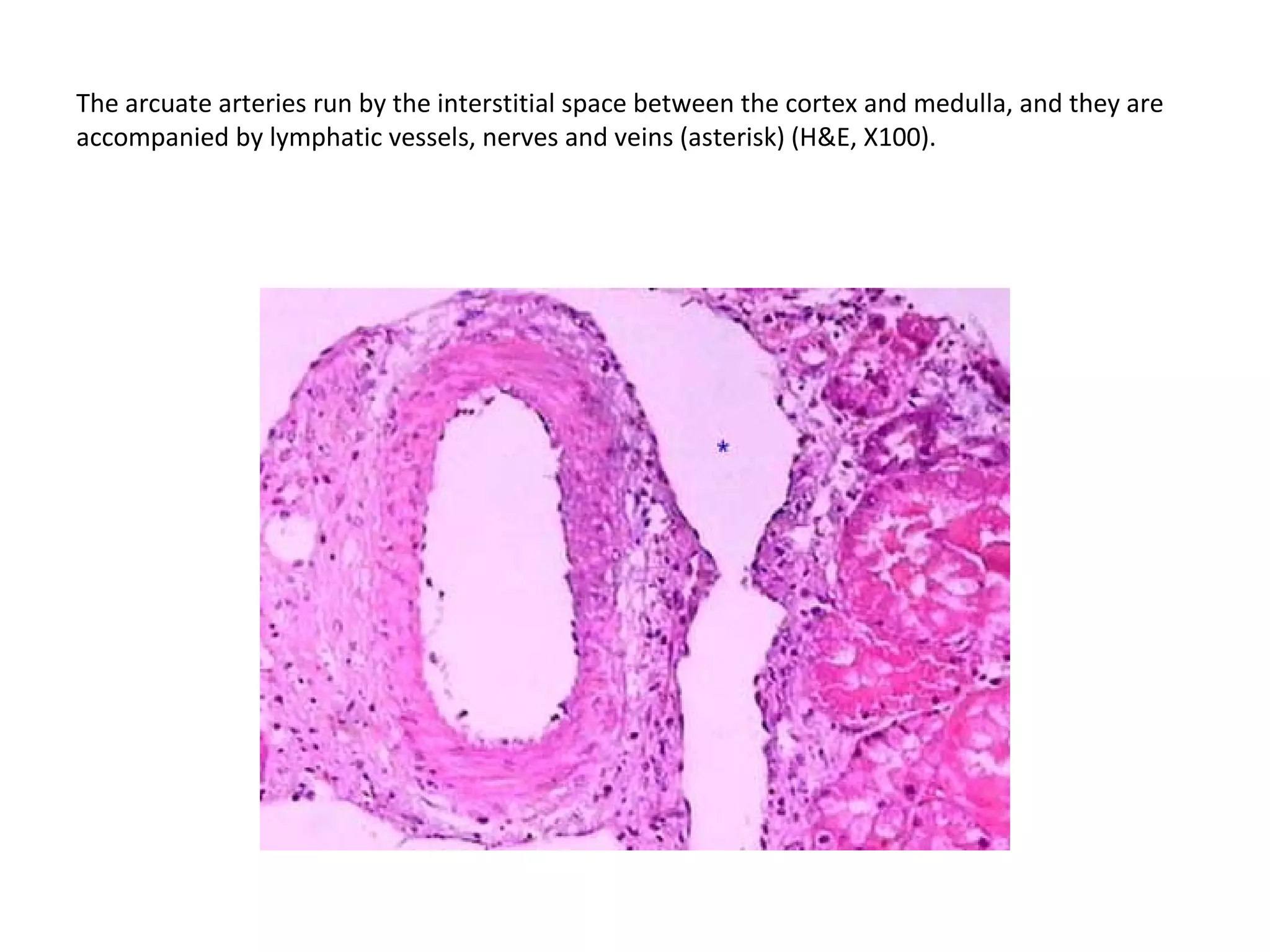 The arcuate arteries run by the interstitial space between the cortex and medulla, and they are accompanied by lymphatic vessels, nerves and veins (asterisk) (H&E, X100). 