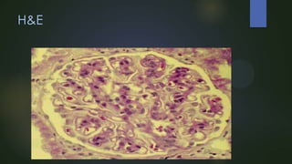 H&E

 