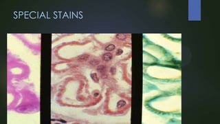 SPECIAL STAINS

IA

L STAINS

 