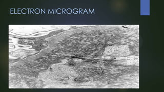 ELECTRON MICROGRAM

 