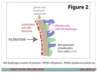 -Slit diaphragm consists of proteins : NPHS-1(Nephrin) , NPHS-2(podocin),actinin etc.
STEP TO PG-MD/MS/DNB - DR.AKIF A.B
 