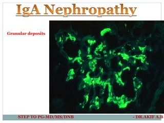 Granular deposits
STEP TO PG-MD/MS/DNB - DR.AKIF A.B
 