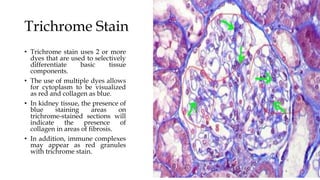 Trichrome Stain
• Trichrome stain uses 2 or more
dyes that are used to selectively
differentiate basic tissue
components.
• The use of multiple dyes allows
for cytoplasm to be visualized
as red and collagen as blue.
• In kidney tissue, the presence of
blue staining areas on
trichrome-stained sections will
indicate the presence of
collagen in areas of fibrosis.
• In addition, immune complexes
may appear as red granules
with trichrome stain.
 