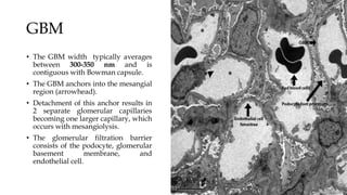 GBM
• The GBM width typically averages
between 300-350 nm and is
contiguous with Bowman capsule.
• The GBM anchors into the mesangial
region (arrowhead).
• Detachment of this anchor results in
2 separate glomerular capillaries
becoming one larger capillary, which
occurs with mesangiolysis.
• The glomerular filtration barrier
consists of the podocyte, glomerular
basement membrane, and
endothelial cell.
 