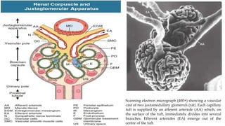 Scanning electron micrograph (400×) showing a vascular
cast of two juxtamedullary glomeruli (rat). Each capillary
tuft is supplied by an afferent arteriole (AA) which, on
the surface of the tuft, immediately divides into several
branches. Efferent arterioles (EA) emerge out of the
centre of the tuft.
 