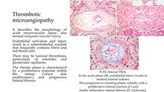 Thrombotic
microangiopathy
It describes the morphology of
acute microvascular injury, also
termed malignant vascular injury.
Endothelial activation and injury
result in a subendothelial exudate
that frequently contains fibrin and
red blood cells.
There may be luminal thrombosis,
particularly of arterioles and
glomerular capillaries.
The chronic phase is characterized
by a proliferative response within
the intima (‘onion skin
proliferation’) and progressive
intimal fibrosis.
B–D) Arterial TMA.
In the acute phase (B), endothelial injury results in
marked intimal oedema.
This progresses to a healing phase, initially with a
proliferative intimal reaction (C) and
finally obliterative intimal fibrosis (D, trichrome).
 