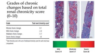 Grades of chronic
changes based on total
renal chronicity score
(0–10)
 
