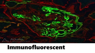 Immunofluorescent
 