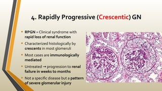Rpgn Patterns Renal Pathology.pdfvdsdsdsdsdsdsdsdsdsdsdsdsdsdsds | PDF
