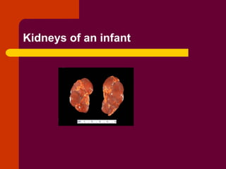 Infant Kidneys Renal Pathology with detailed anatomy of kidney | PPT