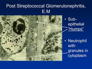 renal-pathology-i-ppt