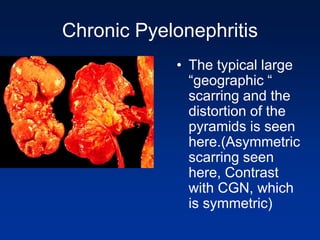 Renal pathology iii | PPT