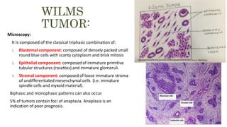 Renal pathology lecture 4 Tumors of kidney and urinary tract. Sufia ...