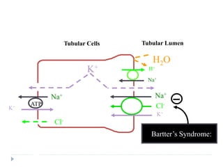 Tubular Lumen
Tubular Cells
Bartter’s Syndrome: Decreased Activity of Na-K-2Cl
Co-Transporter in Thick Ascending Loop of Henle
Na+
ATP
Cl-
K+
K+
Cl-
Na+
ATP
H2O
Bartter’s Syndrome:
K+
Na+
H+
 