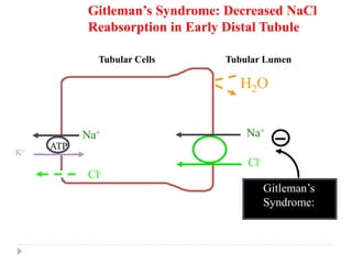 Tubular Lumen
Tubular Cells
Gitleman’s Syndrome: Decreased NaCl
Reabsorption in Early Distal Tubule
Na+
ATP
Cl-
K+
Cl-
Na+
ATP
H2O
Gitleman’s
Syndrome:
 