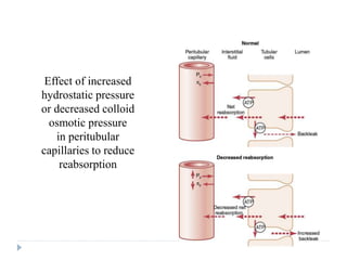 Effect of increased
hydrostatic pressure
or decreased colloid
osmotic pressure
in peritubular
capillaries to reduce
reabsorption
 