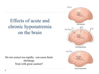 Effects of acute and
chronic hyponatremia
on the brain
Do not correct too rapidly –can cause brain
shrinkage
Treat with great caution!!
 